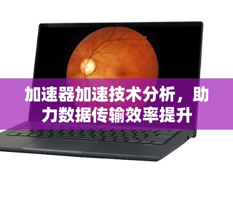 加速器加速技术分析，助力数据传输效率提升